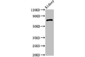 Western Blot Positive WB detected in: Mouse kidney tissue All lanes: ZBTB16 antibody at 2. (ZBTB16 抗体  (AA 126-420))