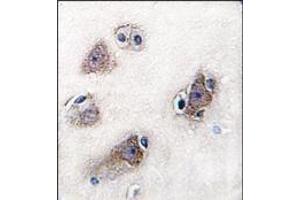 Image no. 2 for anti-Cytochrome P450, Family 26, Subfamily C, Polypeptide 1 (CYP26C1) (C-Term) antibody (ABIN360260) (CYP26C1 抗体  (C-Term))