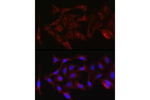 Immunofluorescence (IF) image for anti-Protein Kinase C, zeta (PRKCZ) (AA 453-592) antibody (ABIN6146211)