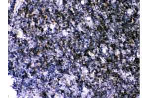 Immunohistochemistry (IHC) image for anti-ATPase, Ca++ Transporting, Ubiquitous (ATP2A3) (AA 1-30), (N-Term) antibody (ABIN3043794)