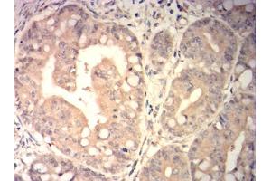 Immunohistochemistry (IHC) image for anti-Sperm Autoantigenic Protein 17 (SPA17) (AA 1-152) antibody (ABIN7193607)