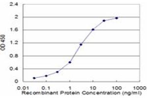 Detection limit for recombinant GST tagged CRYGD is approximately 0. (CRYGD 抗体  (AA 75-174))