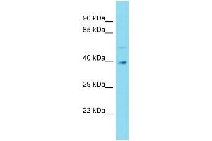 Western Blotting (WB) image for anti-G Protein Pathway Suppressor 2 (GPS2) (N-Term) antibody (ABIN2789898) (GPS2 抗体  (N-Term))
