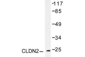 Image no. 2 for anti-Claudin 2 (CLDN2) antibody (ABIN265361) (Claudin 2 抗体)