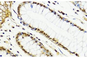 Immunohistochemistry of paraffin-embedded Human colon using CTCF Polyclonal Antibody at dilution of 1:100 (40x lens). (CTCF 抗体)
