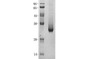 Validation with Western Blot (DCXR Protein (Transcript Variant 2) (His tag))