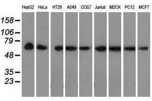 Image no. 2 for anti-Peroxisomal Biogenesis Factor 5 (PEX5) antibody (ABIN1500156) (PEX5 抗体)