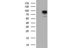Western Blotting (WB) image for anti-phosphoinositide-3-Kinase Adaptor Protein 1 (PIK3AP1) antibody (ABIN1496824) (PIK3AP1 抗体)