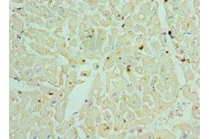 Immunohistochemistry of paraffin-embedded human heart tissue using ABIN7153379 at dilution of 1:100 (TDG 抗体  (AA 141-410))