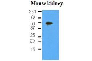 The extracts of mouse kidney (50 ug) were resolved by SDS-PAGE, transferred to nitrocellulose membrane and probed with anti-human PDPN (1:500). (Podoplanin 抗体  (AA 1-206))