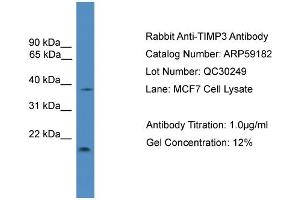 WB Suggested Anti-TIMP3  Antibody Titration: 0. (TIMP3 抗体  (Middle Region))