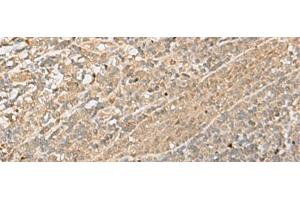 Immunohistochemistry of paraffin-embedded Human tonsil tissue using IPO11 Polyclonal Antibody at dilution of 1:70(x200) (Importin 11 抗体)