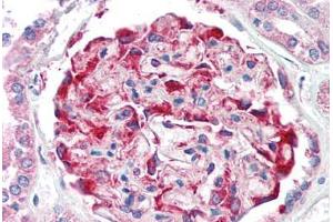 Human Kidney (formalin-fixed, paraffin-embedded) stained with CDH11 antibody ABIN337036 at 5 ug/ml followed by biotinylated goat anti-rabbit IgG secondary antibody ABIN481713, alkaline phosphatase-streptavidin and chromogen. (OB Cadherin 抗体  (Intracellular))