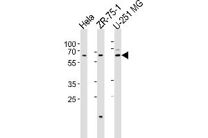 Western blot analysis of lysates from Hela, ZR-75-1, U-251 MG cell line (from left to right), using STS2 Antibody (C-term) (ABIN6244259 and ABIN6577456). (SPATS2 抗体  (C-Term))