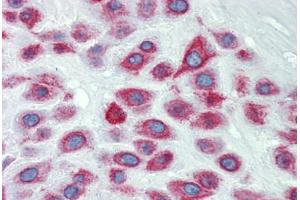 Placenta, Human: Formalin-Fixed, Paraffin-Embedded (FFPE) (LIMD1 抗体  (N-Term))