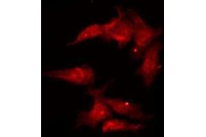 ABIN6269358 staining HT29 by IF/ICC.