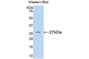 Western Blotting (WB) image for anti-Melanoma Associated Chondroitin Sulfate Proteoglycan (MCSP) (AA 1705-1942) antibody (ABIN1859793) (NG2 抗体  (AA 1705-1942))