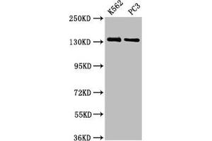 Western Blot Positive WB detected in: K562 whole cell lysate, PC-3 whole cell lysate All lanes: NRDC antibody at 3. (NRD1 抗体  (AA 32-113))