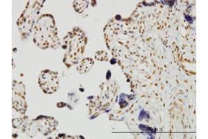 Immunoperoxidase of monoclonal antibody to RUNX2 on formalin-fixed paraffin-embedded human placenta.