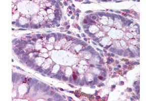 Anti-PLK1 antibody IHC of human colon. (PLK1 抗体  (pThr210))