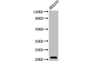 Western Blot Positive WB detected in: HEK293 whole cell lysate All lanes: TSR2 antibody at 2 μg/mL Secondary Goat polyclonal to rabbit IgG at 1/50000 dilution Predicted band size: 21 kDa Observed band size: 21 kDa (TSR2 抗体  (AA 1-191))