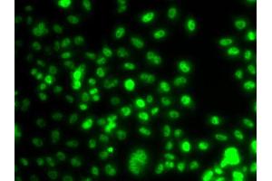 Immunofluorescence analysis of A549 cell using PAX6 antibody. (PAX6 抗体)