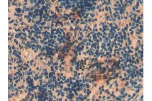 DAB staining on IHC-P; Samples: Mouse Spleen Tissue (MMP8 抗体  (AA 212-451))