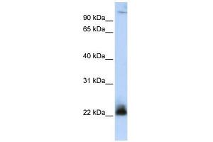 ITGB3BP antibody used at 1 ug/ml to detect target protein. (ITGB3BP 抗体)