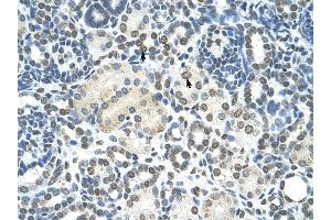 ZMYND11 antibody was used for immunohistochemistry at a concentration of 4-8 ug/ml to stain Epithelial cells of renal tubule (arrows) in Human Kidney. (ZMYND11 抗体  (N-Term))