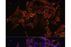 Immunofluorescence analysis of HeLa cells using PTGS1 Polyclonal Antibody at dilution of 1:100 (40x lens). (PTGS1 抗体)
