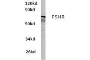 Image no. 1 for anti-Follicle Stimulating Hormone Receptor (FSHR) antibody (ABIN317650) (FSHR 抗体)