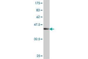 Western Blot detection against Immunogen (45. (UBE2C 抗体  (AA 1-179))