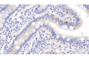 Immunohistochemistry (IHC) image for anti-Calreticulin (CALR) (AA 196-310) antibody (ABIN7438052)