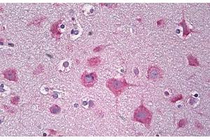 Anti-PARD3 antibody IHC staining of human brain, cortex neurons. (PARD3 抗体  (AA 1141-1190))