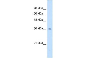 NUDT9 antibody used at 1 ug/ml to detect target protein. (NUDT9 抗体)