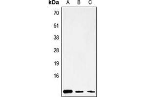 Mitochondrially Encoded ATP Synthase 8 (MT-ATP8) (Center) 抗体