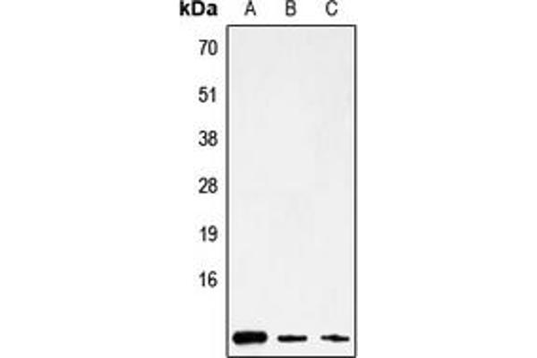 Mitochondrially Encoded ATP Synthase 8 (MT-ATP8) (Center) 抗体