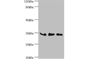 Western blot All lanes: SRM antibody at 8 μg/mL Lane 1: PC-3 whole cell lysate Lane 2: Hela whole cell lysate Lane 3: HepG2 whole cell lysate Secondary Goat polyclonal to rabbit IgG at 1/10000 dilution Predicted band size: 34 kDa Observed band size: 34 kDa (Spermidine Synthase 抗体  (AA 1-302))