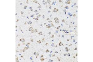 Immunohistochemistry of paraffin-embedded mouse brain using USP25 antibody at dilution of 1:100 (x40 lens). (USP25 抗体)