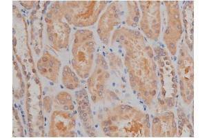 ABIN6267334 at 1/200 staining Human kidney tissue sections by IHC-P. (SP1 抗体  (pThr739))