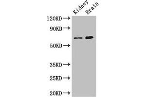 Western Blot Positive WB detected in: Mouse kidney tissue, Mouse brain tissue All lanes: ME3 antibody at 3 μg/mL Secondary Goat polyclonal to rabbit IgG at 1/50000 dilution Predicted band size: 68, 39 kDa Observed band size: 68 kDa (ME3 抗体  (AA 547-598))