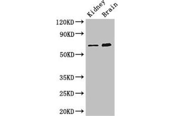ME3 Antikörper  (AA 547-598)