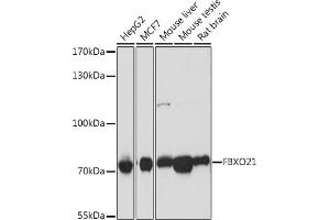 Western blot analysis of extracts of various cell lines, using FBXO21 antibody (ABIN7267085) at 1:1000 dilution.