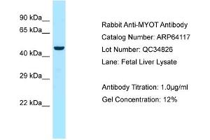 Western Blotting (WB) image for anti-Myotilin (MYOT) (C-Term) antibody (ABIN2789737) (Myotilin 抗体  (C-Term))