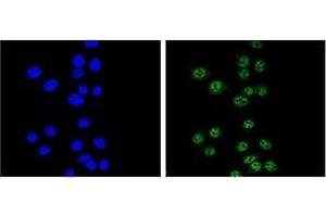 Immunofluorescence (IF) image for anti-Nibrin (NBN) (AA 609-638), (C-Term) antibody (ABIN953701)