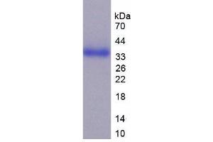 SDS-PAGE analysis of Human CD24 Protein. (CD24 蛋白)