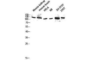 Western Blot (WB) analysis of Mouse Kidney Mouse Brain HeLa KB SH-SY5Y 293T lysis using GCP5 antibody. (TUBGCP5 抗体  (Internal Region))