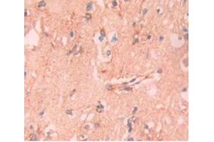 DAB staining on IHC-P;Samples:Human Brain Tissue. (APOA5 抗体  (AA 167-335))