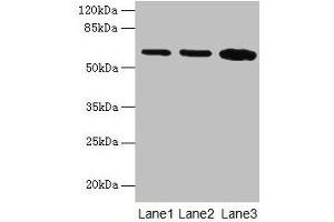 Western blot All lanes: SPTLC2 antibody at 12 μg/mL Lane 1: HepG2 whole cell lysate Lane 2: A549 whole cell lysate Lane 3: HT29 whole cell lysate Secondary Goat polyclonal to rabbit IgG at 1/10000 dilution Predicted band size: 63 kDa Observed band size: 63 kDa (SPTLC2 抗体  (AA 88-562))