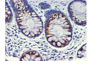 Immunohistochemical staining of paraffin-embedded Human colon tissue using anti-GOLM1 mouse monoclonal antibody. (GOLM1 抗体)